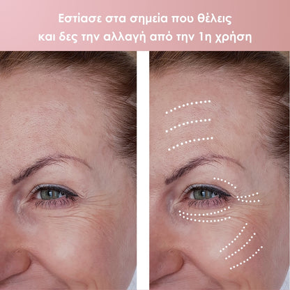 TAPELIFT™ Ταινίες Προσώπου για Φυσικό Lifting